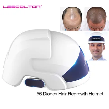 Быстрое обновление лазерного шлема от выпадения волос